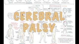 Cerebral Palsy  DETAILED Overview [upl. by Annovahs652]