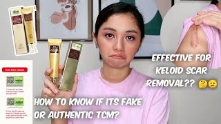 TCM SCAR AND ACNE MARK REMOVAL GEL OINTMENT 1 Tube Review and How to know if its Fake or Authentic [upl. by Christiansen893]