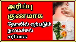 அரிப்பு குணமாக  itching problem solution  arippu treatment  Tamil  Thanithuvamm [upl. by Ikilisav]