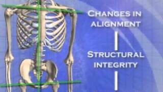 About the Atlas Orthogonal procedure [upl. by Yllus]