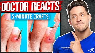 The WORST 5Minute Crafts “Health Hacks” [upl. by Olivann]