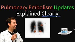 Pulmonary Embolism  Thromboembolism Updates Explained Clearly [upl. by Odlanier671]