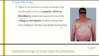 Pathophysiology of cushing syndrome [upl. by Mayyahk]