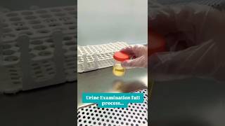 Urine exam fluid process [upl. by Coleville594]