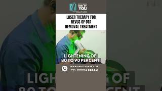 Laser Therapy for Nevus of OTA Removal Treatment  Nevus of OTA Treatment in Delhi  Dr PK Talwar [upl. by Lama]