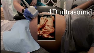 27 weeks pregnant 4D ultrasound [upl. by Ruzich]