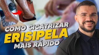 MELHOR CURATIVO PARA ERISIPELA [upl. by Gabrielson]