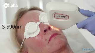 Alpha System 808nm Diode Laser  3D IPL introduction video French [upl. by Ahcarb]