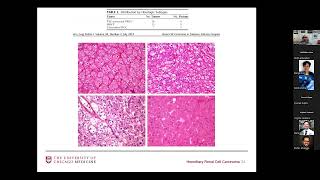 GUPS Virtual Education Series  Hereditary Renal Cell Carcinoma 04112024 [upl. by Abramson]