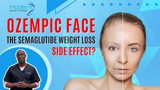 The Ozempic Face Side Effect  Does Semaglutide Make You Look Older [upl. by Acillegna]