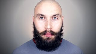 MINOXIDIL BEARD JOURNEY  3 MONTH UPDATE [upl. by Ahsitauq780]