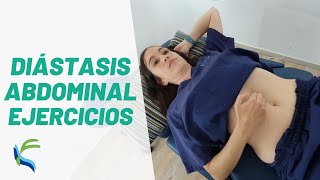 EJERCICIOS corregir la DIASTASIS ABDOMINAL  Fisiolution [upl. by Dayle]