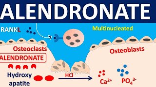 Alendronate for osteoporosis  Mechanism side effects precautions amp uses [upl. by Iveel]