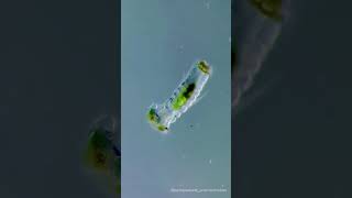 Polychaete worm larvae Beauty of the micro world micro art [upl. by Brosy354]