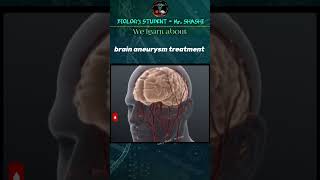 Brain aneurysm treatment shortsfeed shorts trending viralvideo biology science ytshorts 3d [upl. by Aelanna]