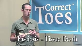 Plantar Fasciitis or Fasciosis [upl. by Roger]