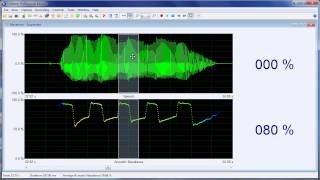 Measuring nasality with the Nasality Microphone [upl. by Ttenaej]