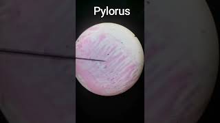 Pylorus [upl. by Lenroc]