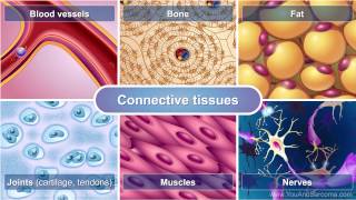 Understanding Soft Tissue Sarcoma [upl. by Lieberman162]