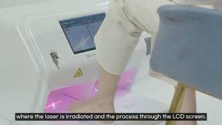 Mycosis Laser 소개영상 English Ver [upl. by Tunk]