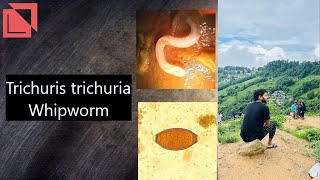 parasitology Trichuris trichura Whipworm norcet microbiology labtechnician mltlab [upl. by Fried]