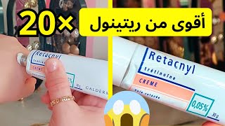 أخيرا جربت كريم retacnyl 005 🤩  كريم ريتاكنيل للوجه  retacnyl [upl. by Fancie]