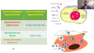 Type IV – Hypersensitivity Reactions Part 4 [upl. by Leonardo]