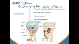 osteomielitis [upl. by Rogovy]