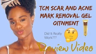 TCM Scar and Acne Mark Removal Gel Ointment Did it really work Review Video [upl. by Ekusuy969]