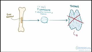 Digeorge Syndrome Osmosis [upl. by Gniliem]