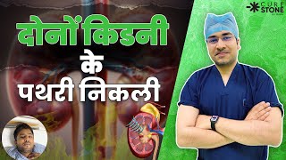 दोनों किडनी के पथरी निकली  Ectopic Kidney Stone Treatment kidneydisease rirs [upl. by Astor418]