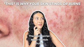 Signs of Damaged Skin Barrier Youre Probably Ignoring [upl. by Garzon197]