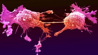 New Cancer Drug Shrinks All Tumors [upl. by Ahsram]