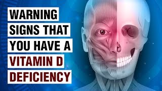 14 Signs Of Vitamin D Deficiency [upl. by Ahsiekat186]