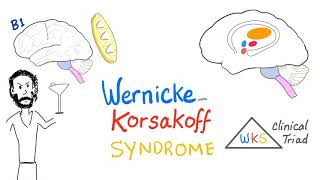 WernickeKorsakoff Syndrome WKS  Biochemistry  Diet and Nutrition [upl. by Aicilram]