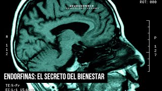 Endorfinas La ciencia del bienestar y la felicidad natural [upl. by Ahsap672]