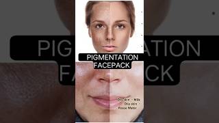 PIGMENTATION PACK gonaturesoap [upl. by Suivatnad41]