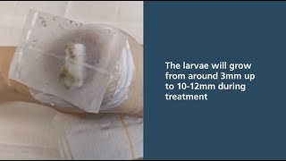 Larval Therapy application using bagged larvae for wound debridement [upl. by Kahl919]