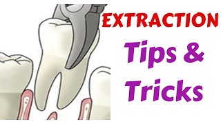 Exodontia Tips amp Tricks  Diagnosis amp Treatment Panning  Indication Medical amp Dental Evaluation [upl. by Youngran]