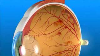 Understanding Proliferative Diabetic Retinopathy [upl. by Theadora]