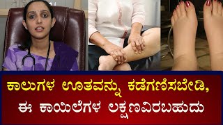 Swollen Feet and Ankles Causes amp Symptoms  Vijay Karnataka [upl. by Ettennod]