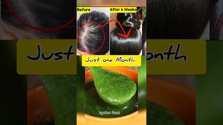 😱உங்க தலையில் முடி இல்லையா Just One Month 🔥Get New Hair😱 baldness tips [upl. by Ahsemad548]