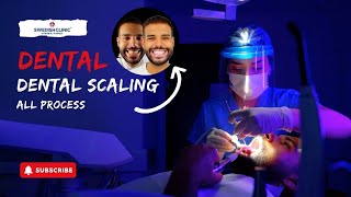 Dental Scaling All Process [upl. by Libbie]