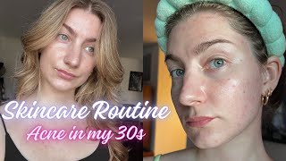 Skincare Routine  Acne in my 30s [upl. by Anaib221]