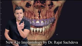 STOP Wasting Money on Dental Implants Until You Watch This [upl. by Iahc]