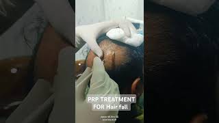 PRP Best hair loss treatment short video [upl. by Strickland865]