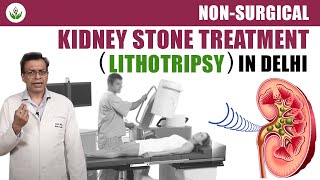 Non Surgical Kidney Stone Treatment Lithotripsy in Delhi  Care Well Medical Centre [upl. by Ashwin]