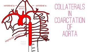 Collateral Circulation in Coarctation of Aorta  Made Easy [upl. by Zosema]