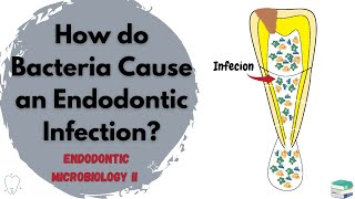 Understanding Endodontic Infections  Endodontic Microbiology Part II [upl. by Aiksas]