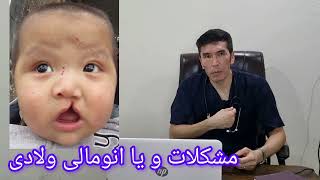 انومالی ولادی یا Congenital anomaly [upl. by Aaberg]